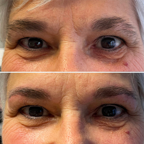 Maquillage permanent des sourcils (microblading) Lille