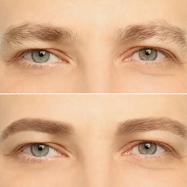 maquillage-permanent-sourcils-homme-avant-apres-3