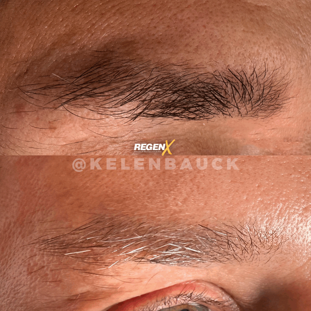 RegenX - Solution sourcils clairsemés