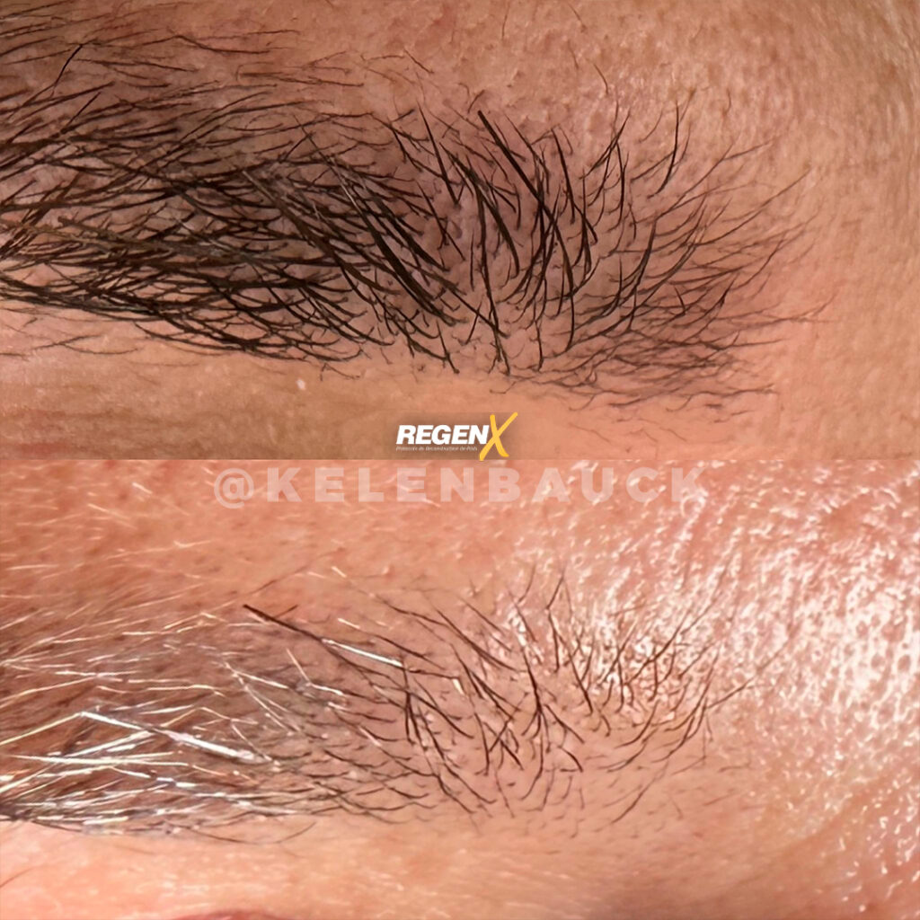 RegenX - Solution sourcils clairsemés