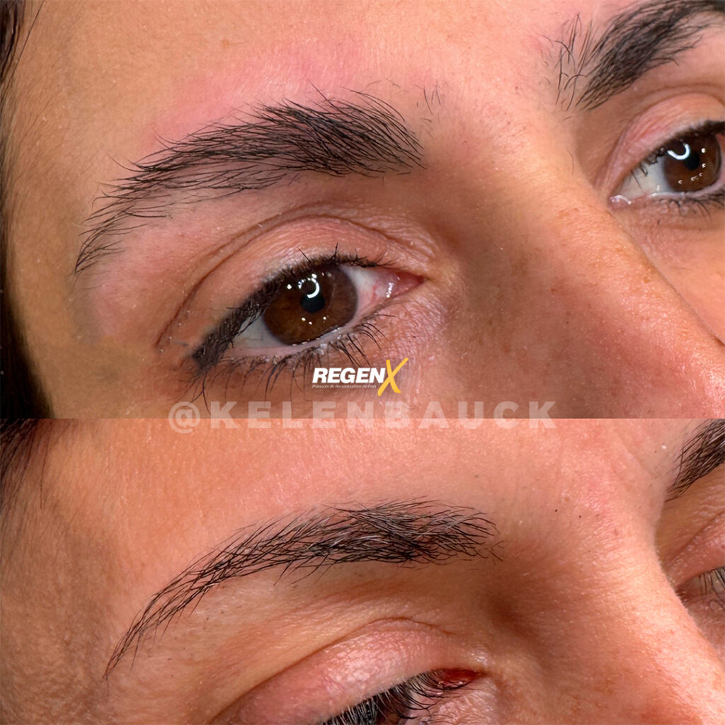 RegenX - Solution sourcils clairsemés