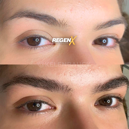RegenX - Solution sourcils clairsemés