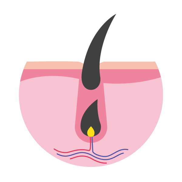 Cycle pilaire - Phase anagène précoce