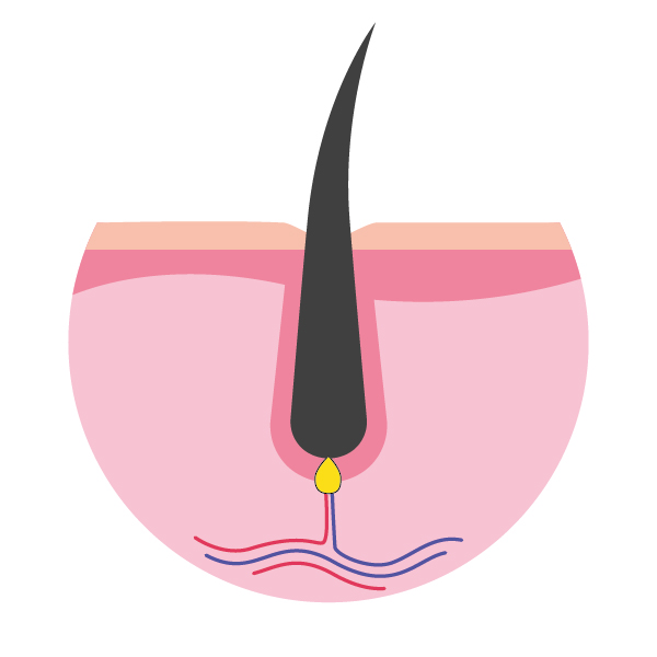 Cycle pilaire - Phase catagène