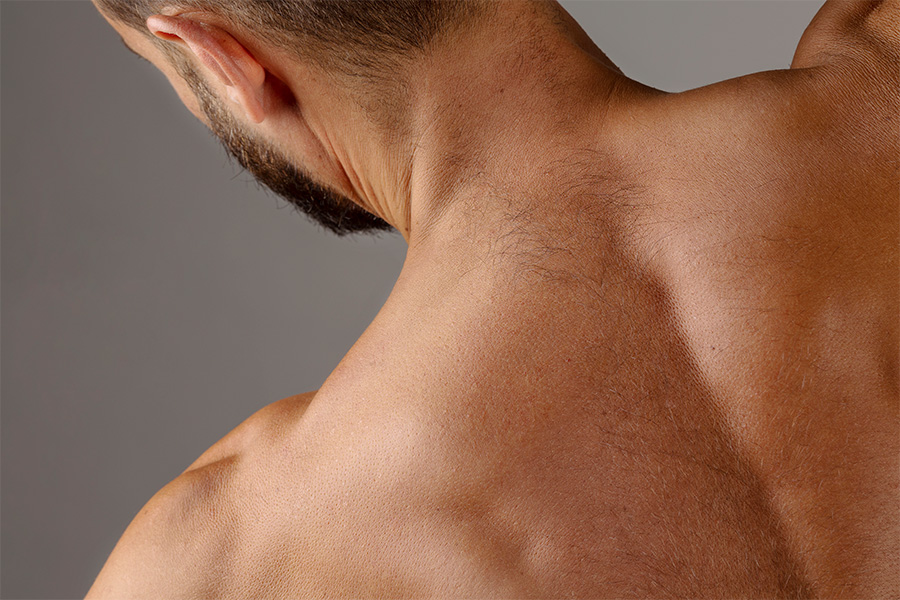 Épilation définitive épaules dos homme Lille – laser chez DermoKliniK