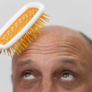 Tricopigmentation-homme-chauve-brosse